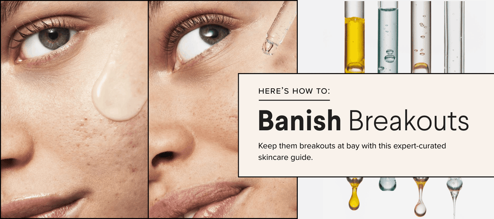 The Expert Guide To Keeping Breakouts At Bay 2023
